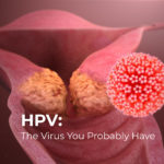 HPV: The Virus You Probably Have